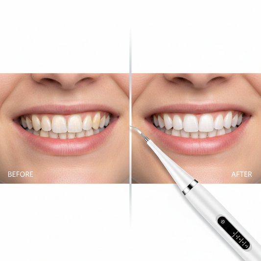 Removedor Sarro Dental Electrico